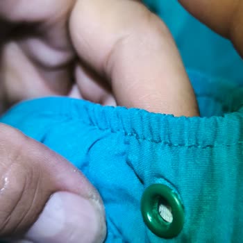 Teslim Edilen Şortun Metal Parçasında Deformasyon Ve İade Sorunu