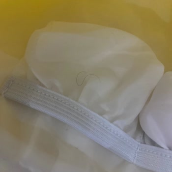 Philips Lumea Cihazım Arızalandı Servis Sürecinde Çanta Ve Şarj Aleti Değiştirildi