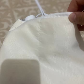 Philips Lumea Cihazım Arızalandı Servis Sürecinde Çanta Ve Şarj Aleti Değiştirildi