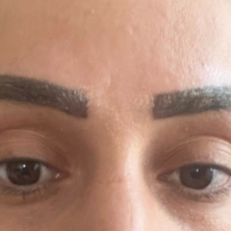 Yanlış Uygulama Sonrası Kaşlarım Kötü Durumda