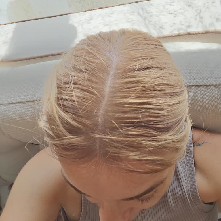 Yanlış Boya İşlemi Ve Saç Yanması Sonrası İlgisiz Hizmetle Mağduriyet Yaşadım