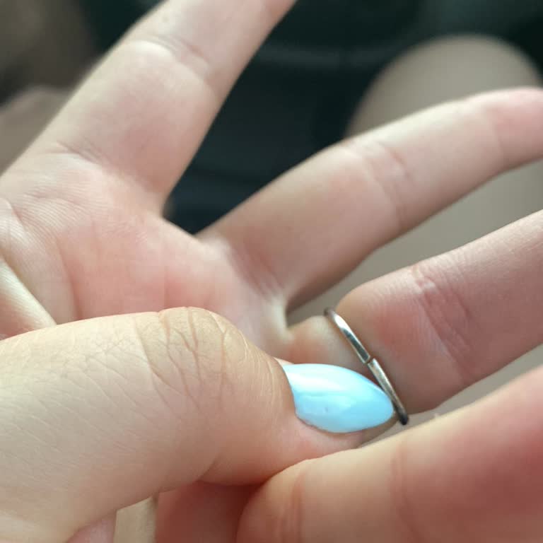 Tamir Sonrası Orijinal Yüzüğüm Yerine Farklı Ve Hafif Bir Yüzük Verildi