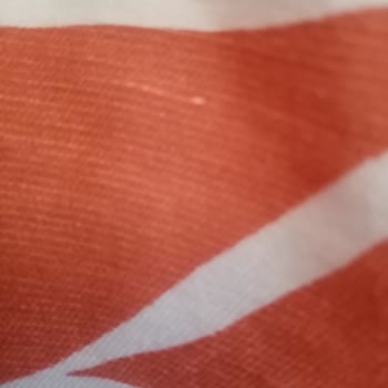 Satın Aldığım Elbisede Kısa Sürede Kumaş Yırtılması Ve Müşteri Hizmetlerine Ulaşamama