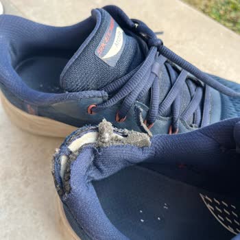 Kısa Sürede Deforme Olan Skechers Ayakkabı Ve Ulaşılamayan Müşteri Hizmetleri