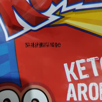 Cipsin İçinden Yabancı Cisim Çıktı, Dişim Kırılıyordu!