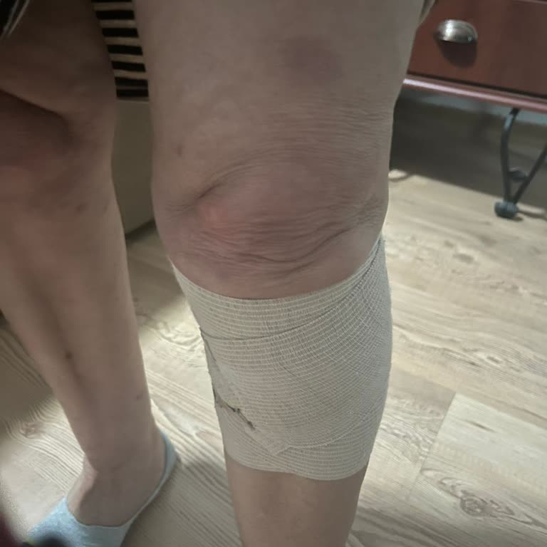 Yaşlı Annemin Otobüste Şoför İhmaliyle Yaralanması Ve İlgisizlik