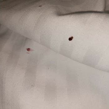 Mütevelli Otel Kastamonu Odamızda Ciddi Bir Tahtakurusu Sorunu Yaşadık