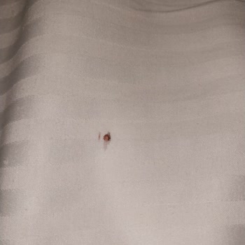 Mütevelli Otel Kastamonu Odamızda Ciddi Bir Tahtakurusu Sorunu Yaşadık