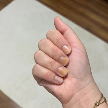 Protez Tırnak İşleminde Hijyen Ve Kalite Sorunları Yaşadım Ücret İadesi İstiyorum