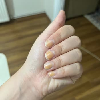 Protez Tırnak İşleminde Hijyen Ve Kalite Sorunları Yaşadım Ücret İadesi İstiyorum