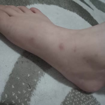 İstikbal Baza Başlığında Böcek Sorunu Ve Yetersiz Servis Desteği