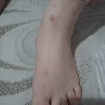 İstikbal Baza Başlığında Böcek Sorunu Ve Yetersiz Servis Desteği