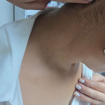 Pandora Kolyede Kararma Ve Alerjiye Çözüm Bulunmadı