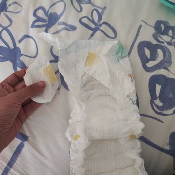 Prima Bebek Bezinde Bant Kopukluğu Nedeniyle Mağduriyet