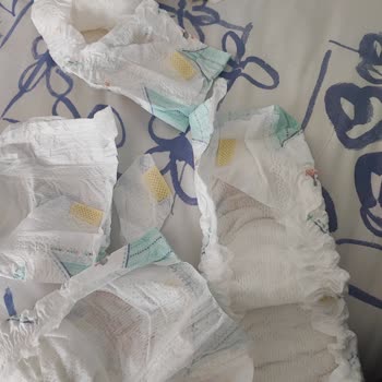 Prima Bebek Bezinde Bant Kopukluğu Nedeniyle Mağduriyet