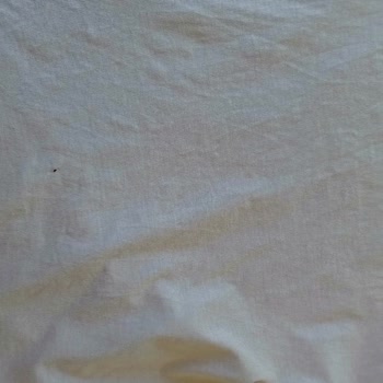 Beko Çamaşır Makinesi Sürekli Arızalı, Kıyafetlerim Zarar Görüyor Ve Mağduriyetim Giderilmiyor