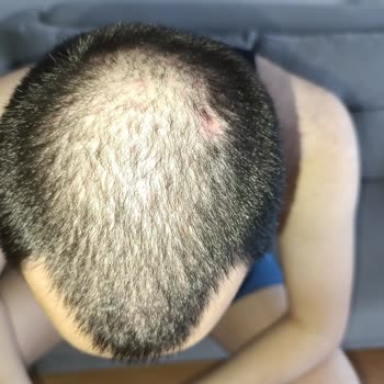 Şampuan Ciddi Sağlık Sorunlarına Yol Açtı, Satıcı Ve Marka Sessiz Kaldı