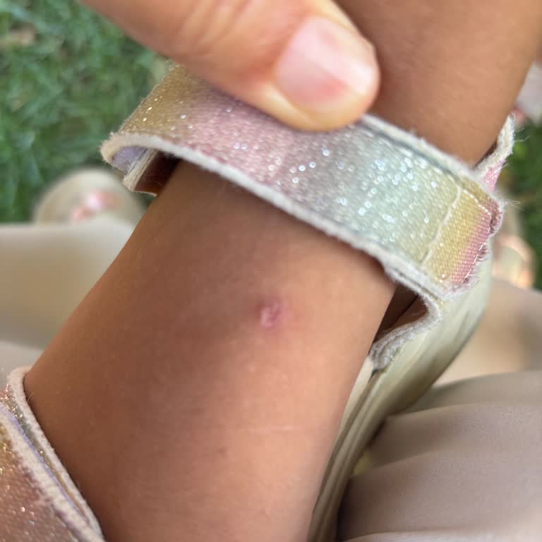 Kısa Sürede Ayağı Yaralayan Ayakkabıya Çözüm Sunulmadı