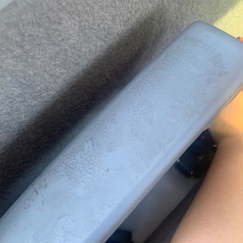 Otobüste Hijyen Eksikliği Ve Sağlıksız Yolculuk Deneyimi