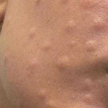 Somon DNA Ve Jel Tırnak İşlemlerinde Hayal Kırıklığı Ve Ücret İadesi Talebi