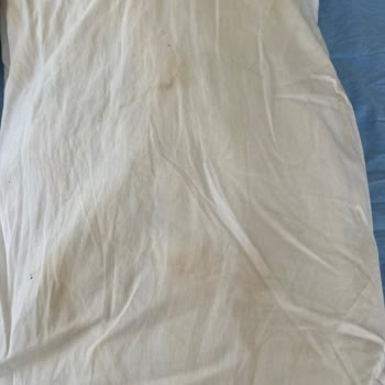 Ciddi Otel Ayvalık'ta Temizlik Sorunları Ve İade Talebi