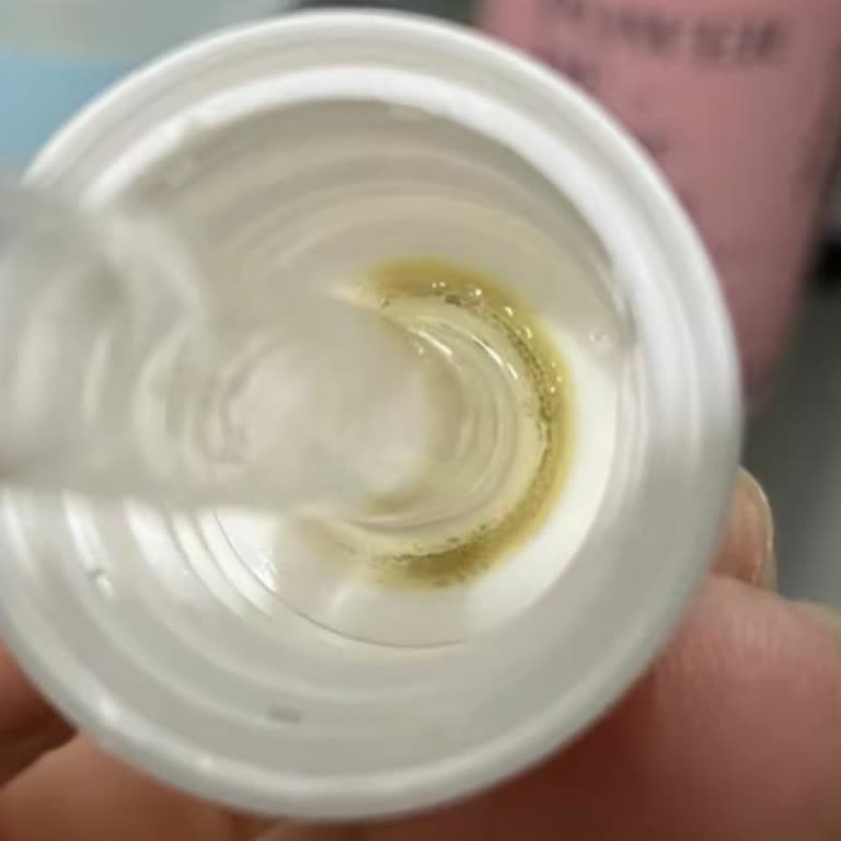 SHE Vec Serumunda Tekrarlayan Küf Problemi Ve Güven Kaybı