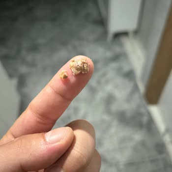 Kefir İçinde Yabancı Cisimle Karşılaştım Hijyen Endişesi Yaşıyorum