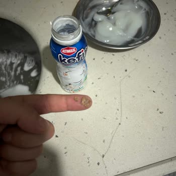 Kefir İçinde Yabancı Cisimle Karşılaştım Hijyen Endişesi Yaşıyorum