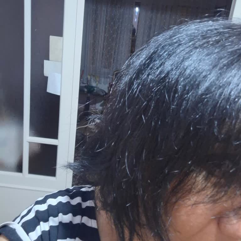 Saç Boyası Kahve Beklerken Siyah Oldu, Mağduriyet Yaşıyorum