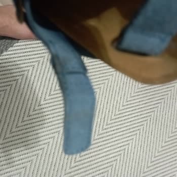 Bebek Sandaletinin Sağlıksız Tasarımı Ayağında Yaralara Sebep Oldu