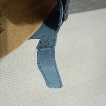 Bebek Sandaletinin Sağlıksız Tasarımı Ayağında Yaralara Sebep Oldu