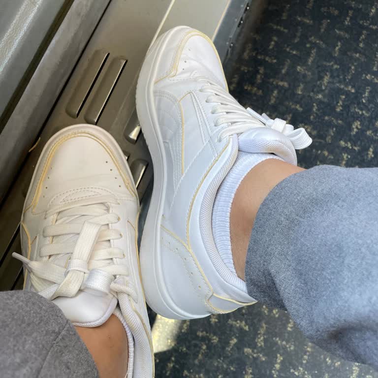 Kısa Sürede Deforme Olan Ayakkabı Ve Yetersiz Müşteri Hizmeti