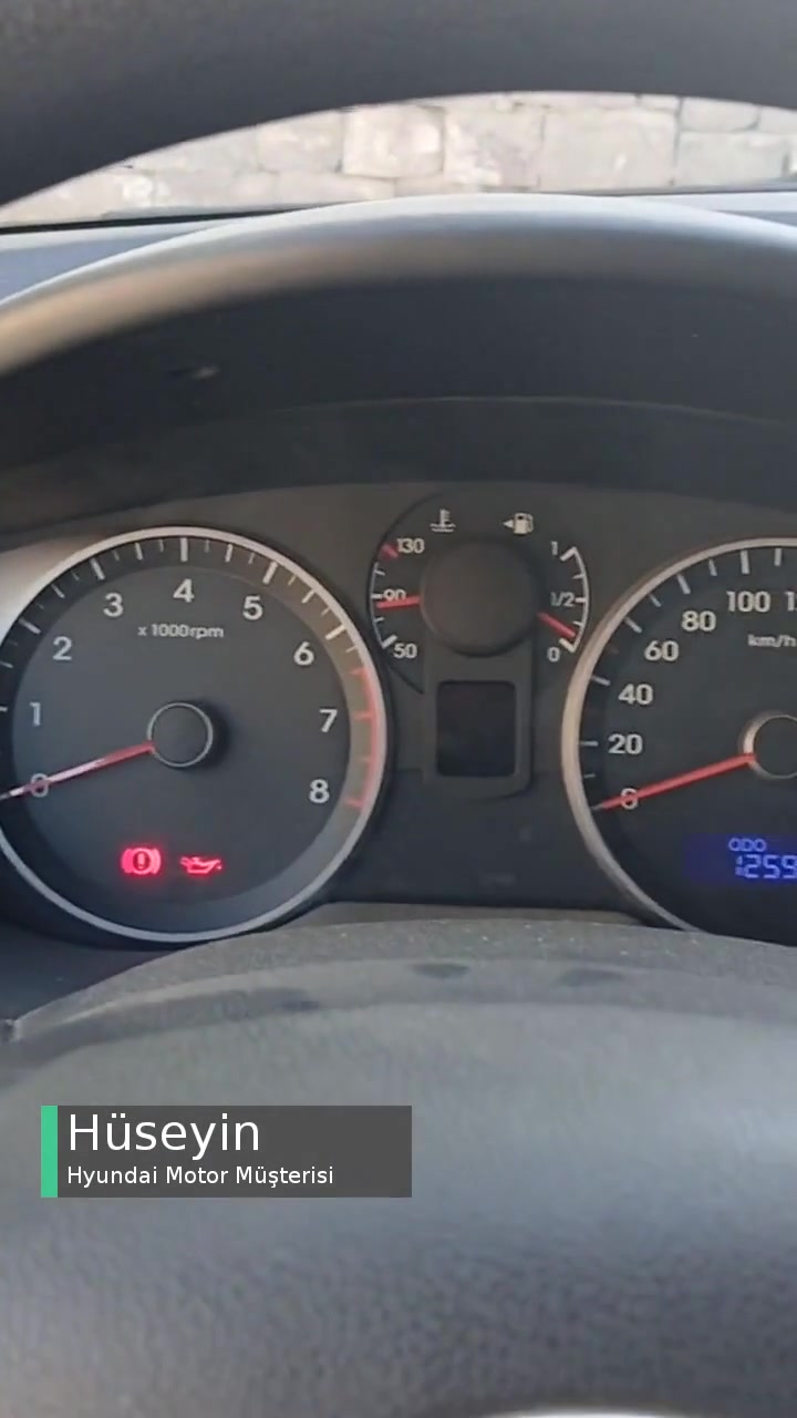 Hyundai Aracına Sahip Çıkamıyor Bozuk Araçlar Satıyor! videonun kapak resmi