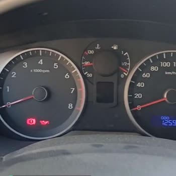 Hyundai Aracına Sahip Çıkamıyor Bozuk Araçlar Satıyor!