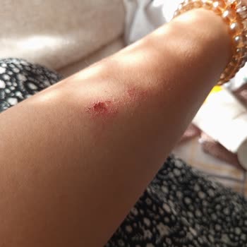 Bioderma Güneş Kreminde Anormal Ayrışma Ve Değişim Talebi