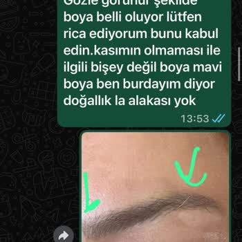 Yapılan Kaş İşleminden Memnun Kalmadım, Sorunlarım Kabul Edilmedi