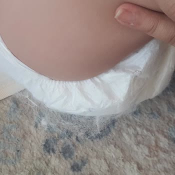 Sleepy Bebek Bezinde Tüylenme Ve Dökülme Sorunu