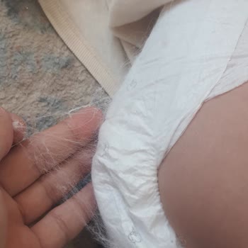 Sleepy Bebek Bezinde Tüylenme Ve Dökülme Sorunu