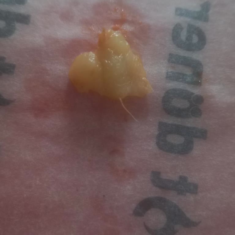 Hot Döner Şubesinde Çiğ Tavuk Ve Hijyen Sorunu: Ücret İadesi Talebim