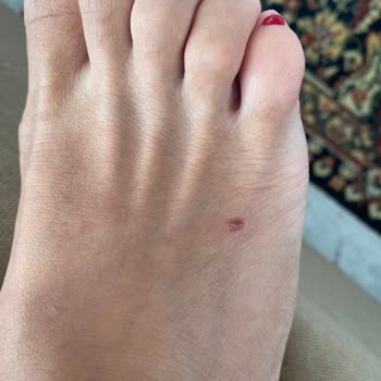 İlk Kullanımda Ciddi Yaralanmaya Sebep Olan Terliğin Değişimi Reddedildi