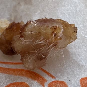 Paket Döner Siparişimde Hijyen Sorunu Ve Yetersiz Çözüm