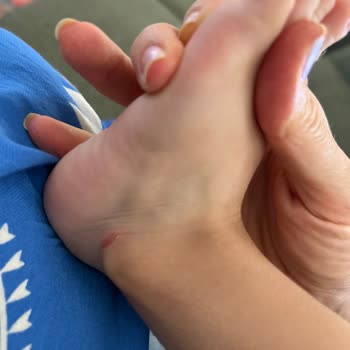 Aynı Markadan Aldığım Sandalet Çocuğumun Ayağını Yaraladı