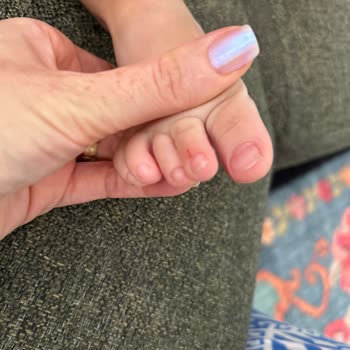 Aynı Markadan Aldığım Sandalet Çocuğumun Ayağını Yaraladı