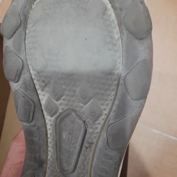 1 Ayda Deforme Olan Ayakkabıya Kullanıcı Hatası Yanıtı Hayal Kırıklığı Yarattı