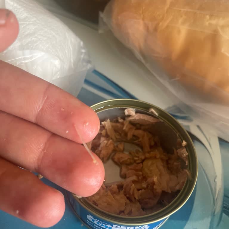 Ton Balığında Çıkan Kılçık Hijyen Endişesi Yarattı