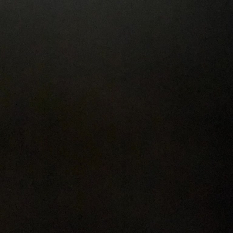 Ataşehir Şubesinde Eksik Epilasyon Hizmeti Ve İade Talebi