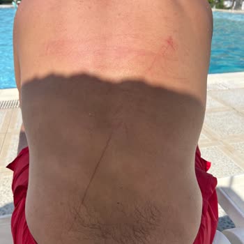 Risus Beach Otelde Kötü Yemekler, Temizlik Sorunları Ve Eksik Hizmet