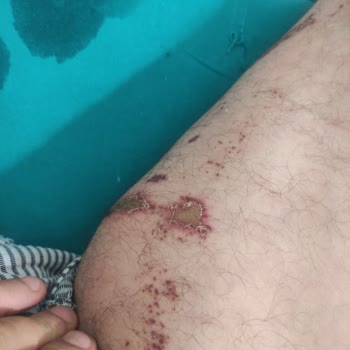 Lavabo Açıcı Kullanımı Sonrası Oluşan Boru Hasarı ve Maddi Kayıp