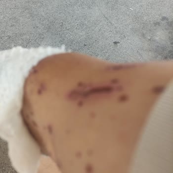 Lavabo Açıcı Kullanımı Sonrası Oluşan Boru Hasarı ve Maddi Kayıp