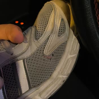 Garantili Adidas Ayakkabım FLO Tarafından Değişim Veya Onarıma Alınmadı